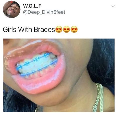 Braces Teeth Colors Cute Braces Colors Teeth Braces Power Chain