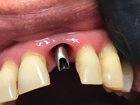 Clínica Dental LC Implantes Dentales Odontólogo