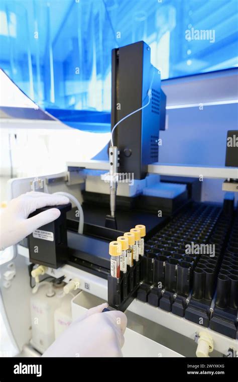 Enzyme Immunoassay Analysis Automated Elisa Processing System