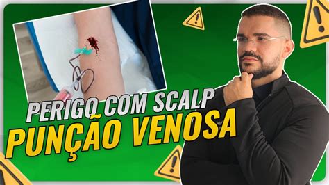 Uso Do Scalp Na Pun O Venosa Aprenda Realizar Pun O Venosa