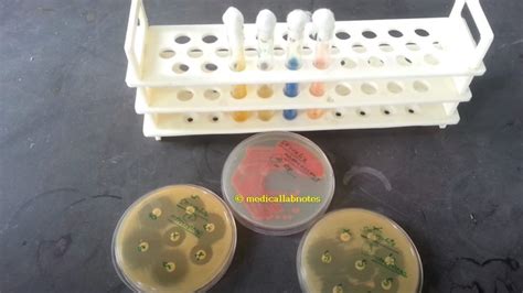 Serratia marcescens colony morphology on nutrient agar Archives - Medical Notes