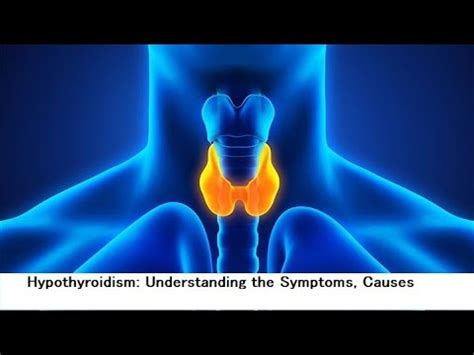 Hypothyroidism Understanding The Symptoms Causes And Treatment