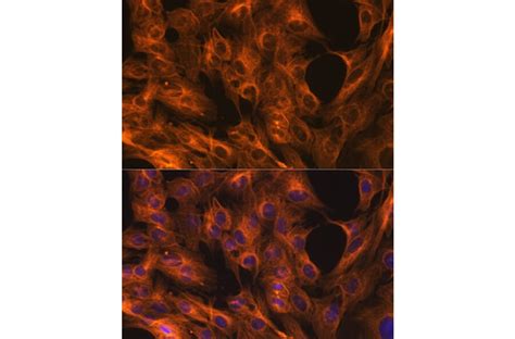 Anti-beta Tubulin Antibody [ARC0203] (A306704) | Antibodies.com