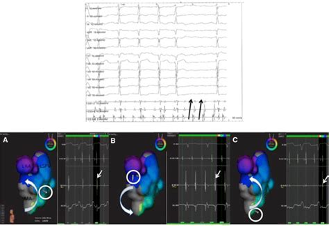 First Clinical Experience Using A Novel High Resolution