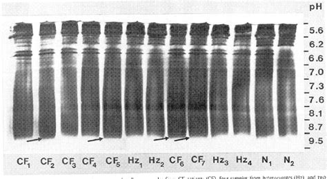 Figure From Detection Of The Cystic Fibrosis Protein By Isoelectric