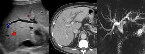 Oncological Radiology (Anatomical) - Virtual Radiology