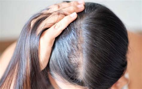 Shedding Hair Why And How To Fix It