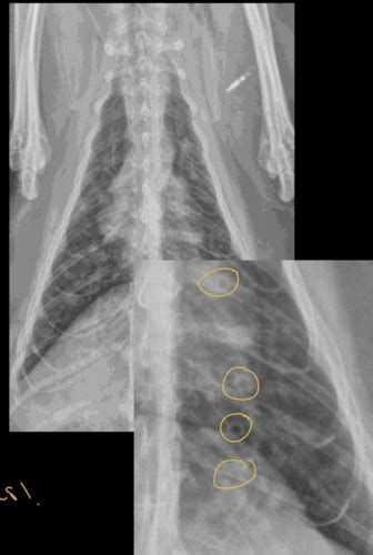 LEC 40 Lower Airway Imaging Flashcards Quizlet