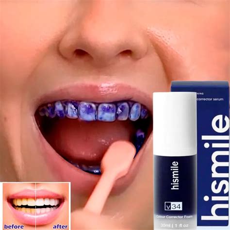 Hismile Creme Dental Para Clareamento Dos Dentes Mousse Clareamento