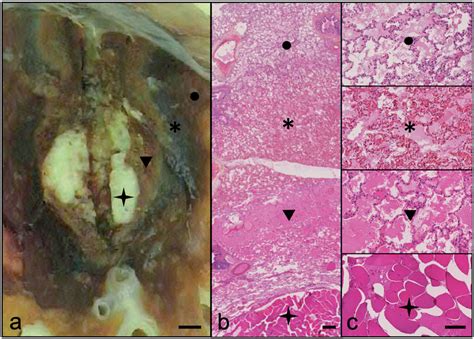 Pathological Assessment Of Ablation Zones This Figure Is A