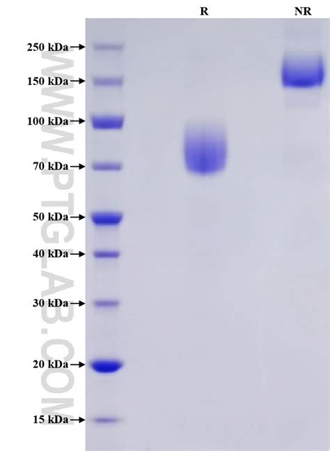 Recombinant Human B Cd Protein Hfc Tag Myc Tag His Tag