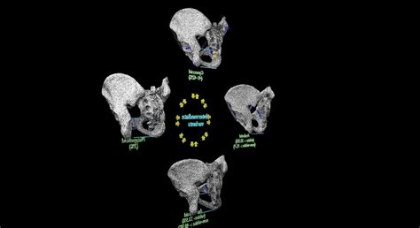 Pelvis types hip bone labelled detailed 3D model animated | CGTrader