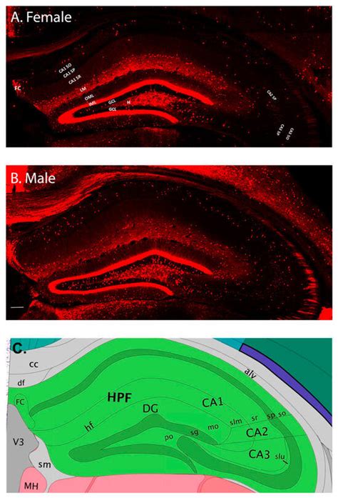 Ijms Free Full Text Sex Specific And Traumatic Brain Injury Effects