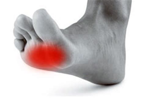 Metatarsalgia (Ball of Foot Pain): Causes and Treatment Options