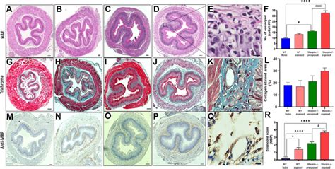 Aspergillus And Ova Exposure Led To Eoe Like Characteristics In The Download Scientific Diagram