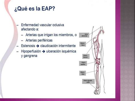 Manejo Actual De La Insuficiencia Arterial Aguda Y Cr Nica Ppt