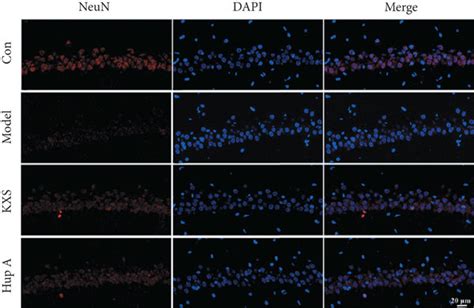 Kxs Treatment Ameliorated Memory And Learning Impairment The Mean