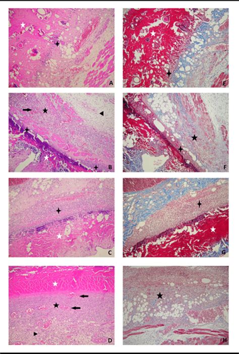 2 Immunohistochemical Staining Of Burn Wound Healing In Skin Biopsies