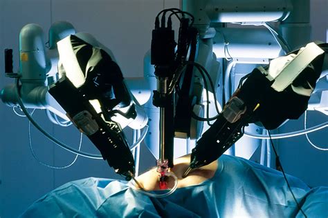 Robotic Surgery New York Gynecology Surgery