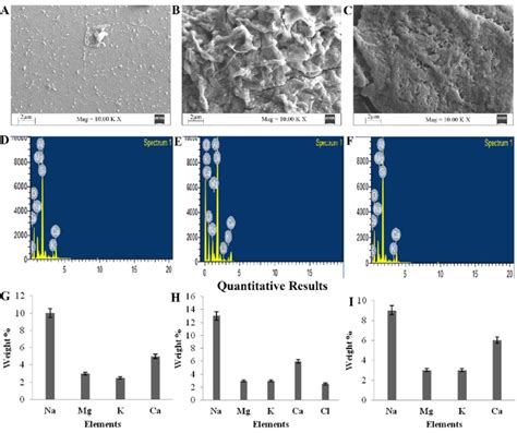 Scanning Electron Microscopic And Sem Edx Analysis Of Saliva During Download Scientific Diagram