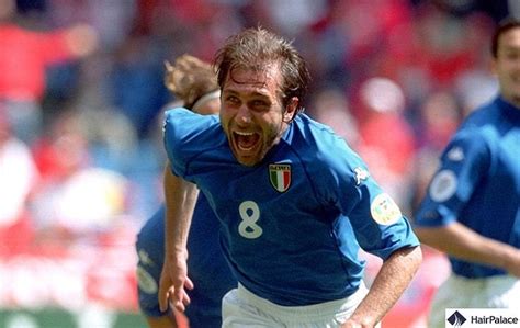 Antonio Conte Hair Transplant | All The Secrets