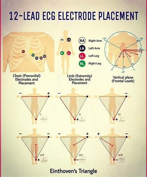 Pinterest Medical School Life Ekg Placement Medical Knowledge