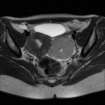 Radiology Quiz 97294 Radiopaedia Org