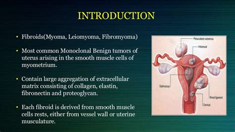 Cervical and broad ligament fibroid