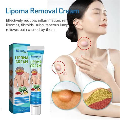 Lipoma Cream Ointment Fat Granule Care External Swelling Cellulite