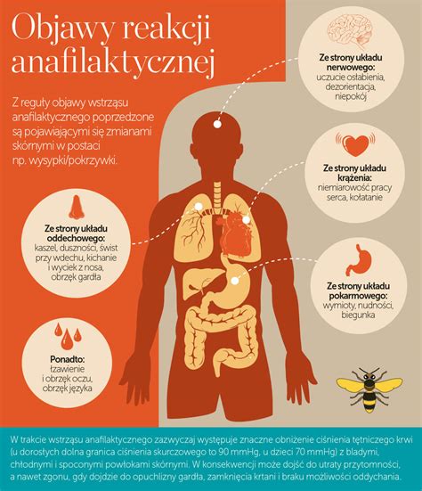 Anafilaksja przyczyny i postępowanie