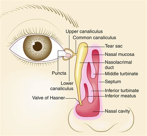 Evaluation And Management Of Congenital Nasolacrimal Duct Obstruction