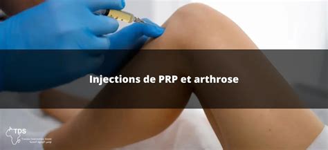 Prp Et Arthrose Traitement Efficace