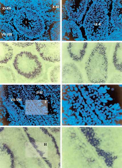 In Situ Hybridization Of Cryo Sections Of Mouse Adult Testis Signal