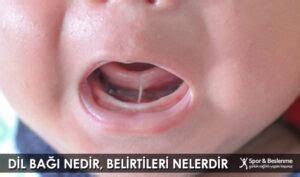 Dil Bağı Nedir Belirtileri Nelerdir Spor ve Beslenme