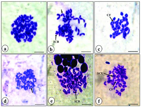 Representative Photomicrographs Of Bone Marrow Metaphase Chromosome