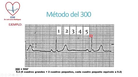 Para C Lculo De La Frecuencia Cardiaca En Un Ecg Youtube