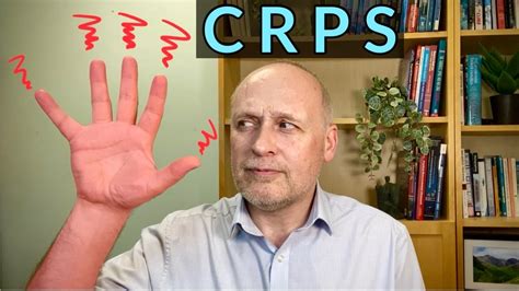 How We Treat Crps Complex Regional Pain Syndrome Using Evidence Based Therapies Youtube