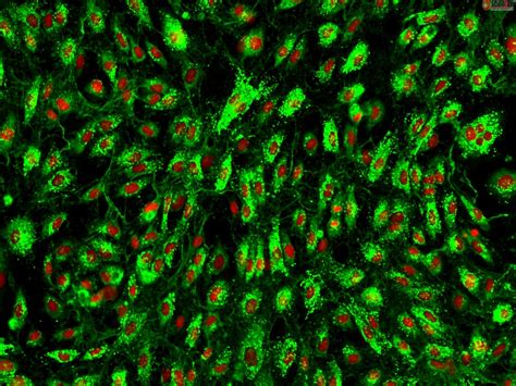 Human Tonsil Endothelial Cells HTEC