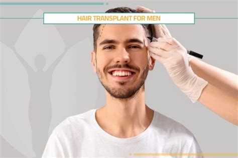 Check Results Before And After Hair Transplant For Men