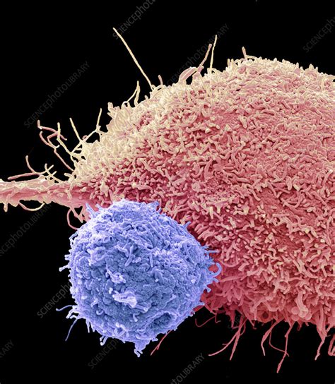 Car T Cell Therapy Sem Stock Image C0569960 Science Photo Library