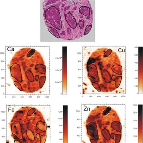 13- μ m resolution μ CT scan of the vasculature of a mouse placenta at... | Download Scientific ...