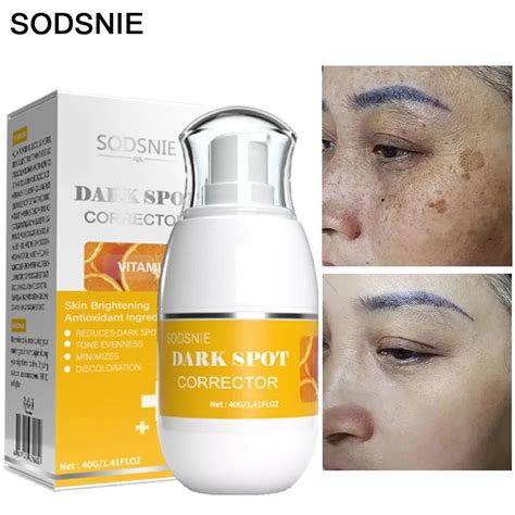 Creme Clareador E Corretor Manchas Escuras Melasma Shopee Brasil