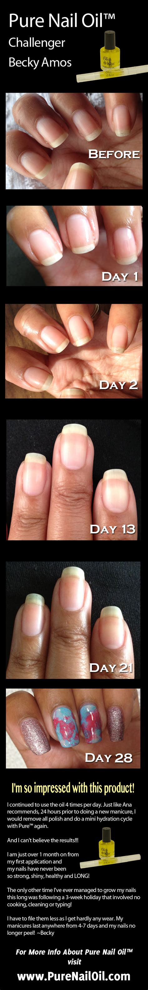 Peeling Nails Pure Nail Oil And Cuticle Oil Challenger Beckys Results