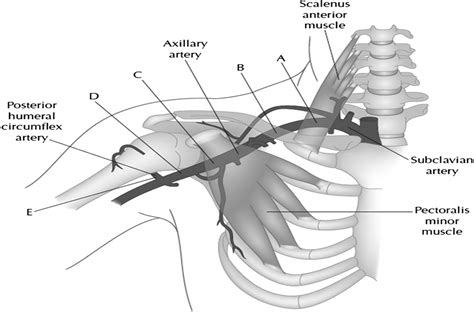 Arterial Thoracic Outlet Syndrome : Current Sports Medicine Reports