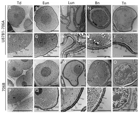 Transmission Electron Micrographs Of The Microspores In U B A