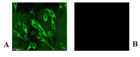 Indirect Immunofluorescence Of Rsv Antigen In Infected Epithelial