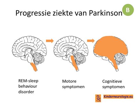 Kinderneurologie Eu