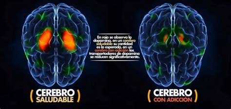 Cómo afecta al cerebro la MDMA