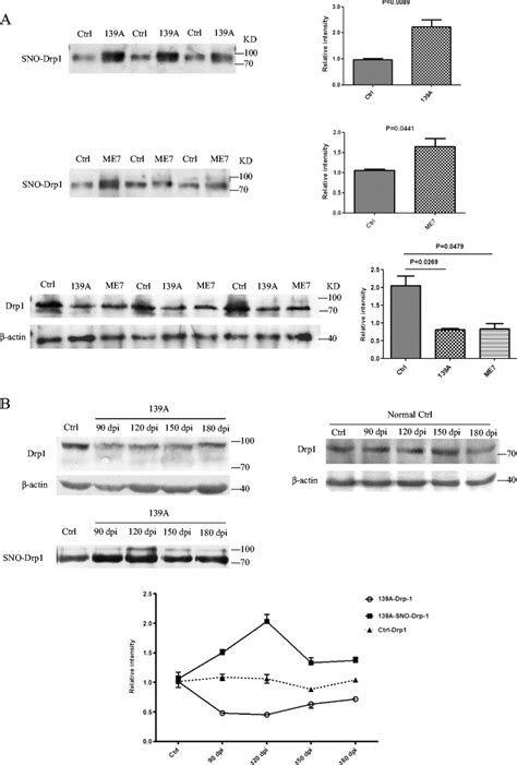 Increases Of Sno Form Of Drp In The Brains Of Scrapie Infected Mice A