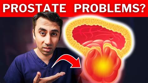 8 Signs YOU Have An Enlarged Prostate BPH Symptoms Doctor Explains